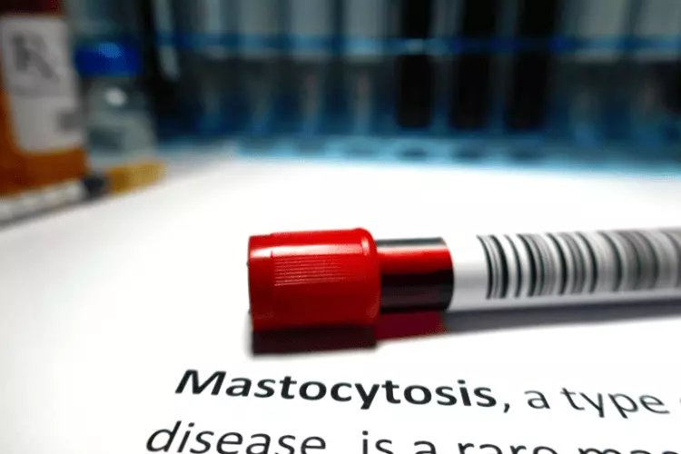 mastocytoza u niemowląt mastocytoza u niemowląt